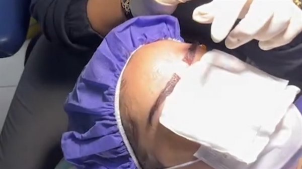  فیلم کاشت ابرو از صفر تا صد + قبل از کاشت ابرو چه داروهایی نباید خورد