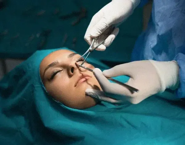  فیلم عمل بینی دختر ۱۶ ساله+فیلم جراحی بینی عروسکی