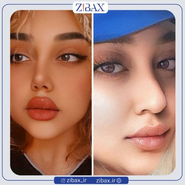 عکس بینی فانتزی عروسکی+مدل بینی فانتزی گوشتی