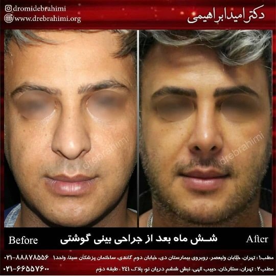  عکس بینی فانتزی عروسکی+مدل بینی فانتزی گوشتی