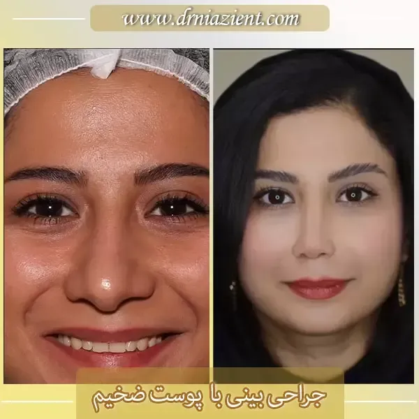  عکس بینی فانتزی عروسکی+مدل بینی فانتزی گوشتی