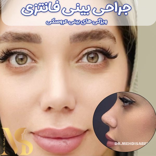  عکس بینی فانتزی عروسکی+مدل بینی فانتزی گوشتی
