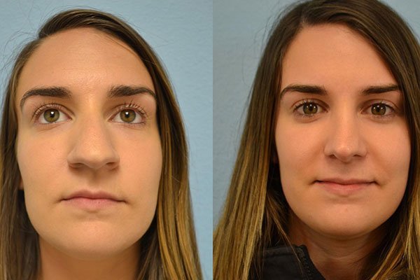  عکس بینی فانتزی عروسکی+مدل بینی فانتزی گوشتی