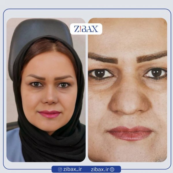  عکس بینی فانتزی عروسکی+مدل بینی فانتزی گوشتی