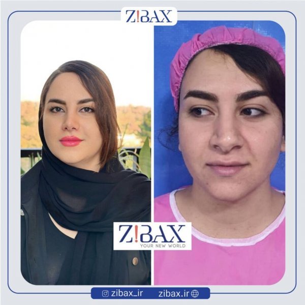  عکس بینی فانتزی عروسکی+مدل بینی فانتزی گوشتی