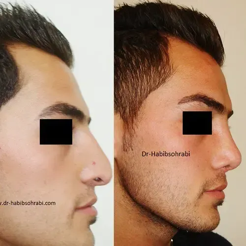  عکس دماغ زیبا + عکس بینی عمل شده زیبا