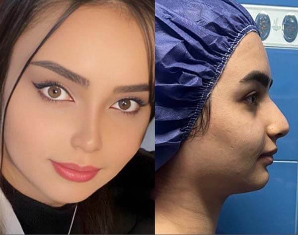  عکس دماغ زیبا + عکس بینی عمل شده زیبا