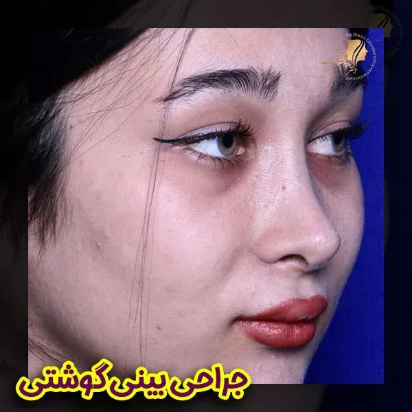  عکس دماغ زیبا + عکس بینی عمل شده زیبا