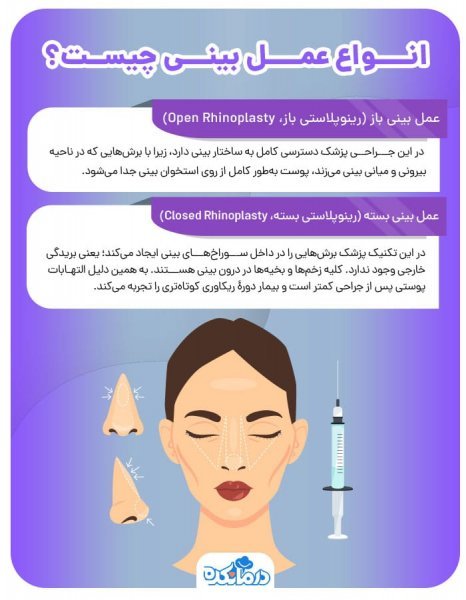  مدت زمان عمل بینی استخوانی