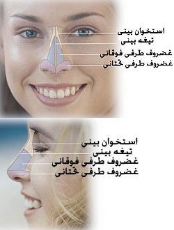  مدت زمان عمل بینی استخوانی