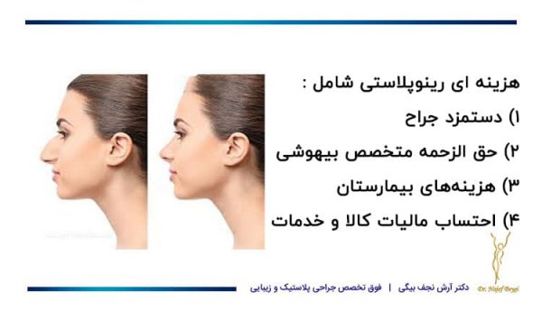  هزینه جراحی بینی چقدر است؟