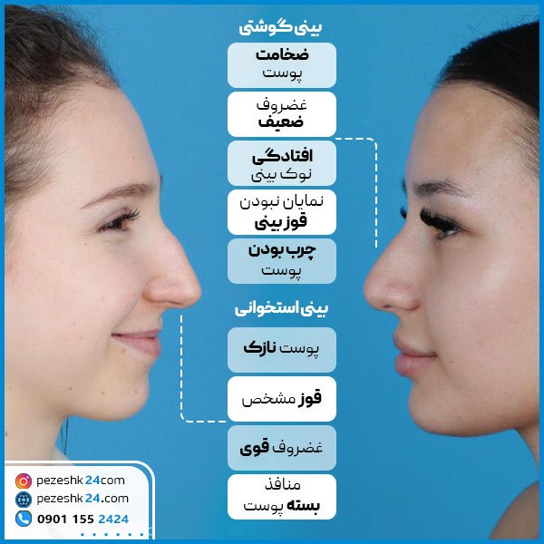  هزینه جراحی بینی چقدر است؟