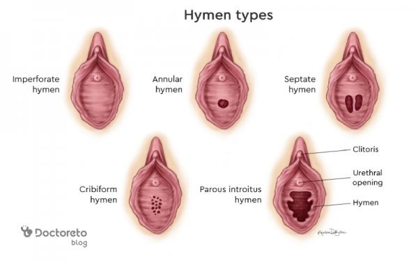  سوالات درباره ترميم بكارت هایمن