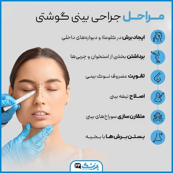 عمل بینی دماغ گوشتی در چه سنی مناسب است؟