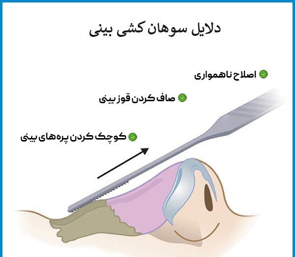  عمل بینی دماغ گوشتی در چه سنی مناسب است؟