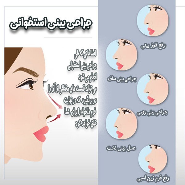  هزینه عمل بینی پهن و گوشتی 1404