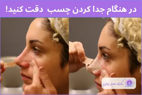  فیلم نحوه چسب زدن بینی استخوانی