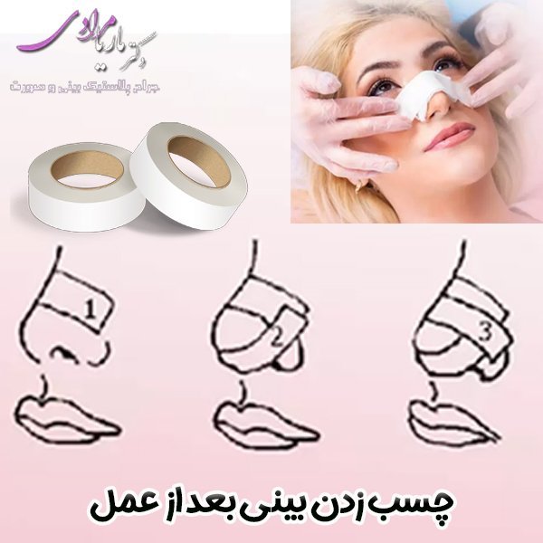  فیلم نحوه چسب زدن بینی استخوانی