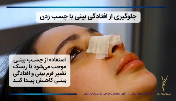  فیلم نحوه چسب زدن بینی استخوانی