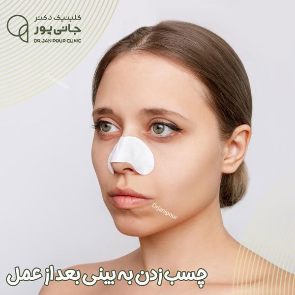  فیلم نحوه چسب زدن بینی استخوانی