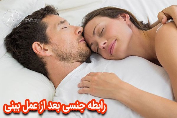 چه مدت بعد از عمل بینی میتوان رابطه جنسی سکس داشت