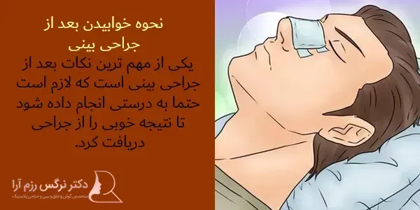  چه مدت بعد از عمل بینی میتوان رابطه جنسی سکس داشت