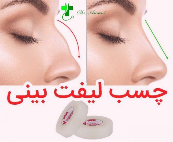  چه مدت بعد از عمل بینی میتوان رابطه جنسی سکس داشت