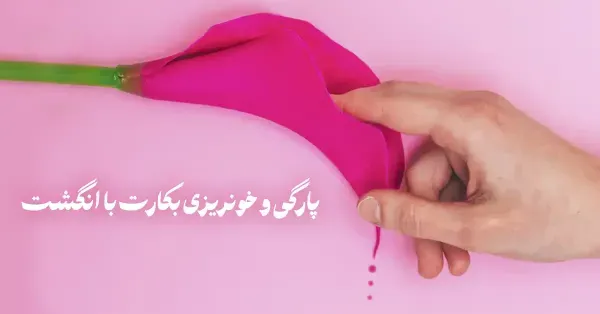  شکل پرده بکارت هایمن طبیعی