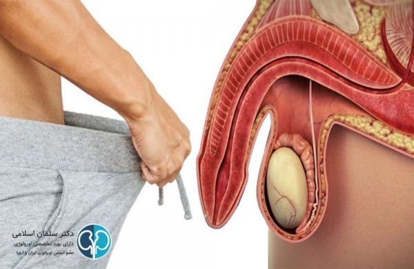  چرا آلتم وسط رابطه جنسی سکس شل میشه