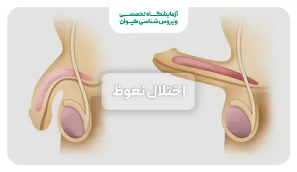  چرا آلتم وسط رابطه جنسی سکس شل میشه