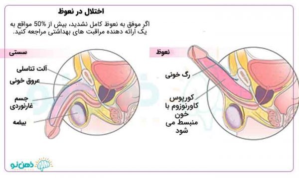  چرا آلتم وسط رابطه جنسی سکس شل میشه