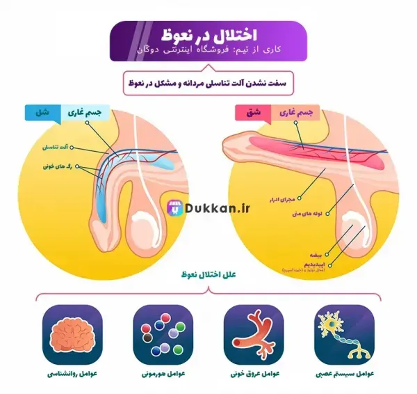  چرا آلتم وسط رابطه جنسی سکس شل میشه