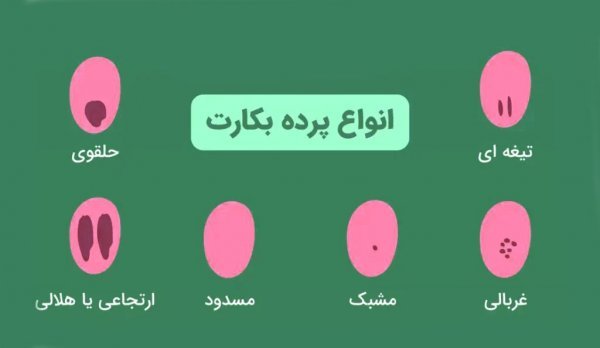  چگونه بفهمیم پرده بکارت سالم است با عکس