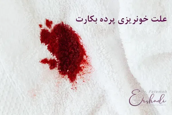 وقتی پرده زده میشه (پرده بکارت) چقدر خون میاد