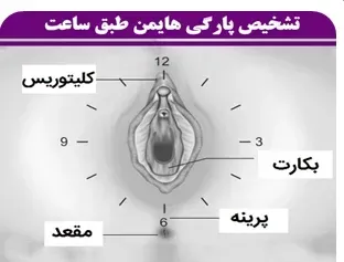  وقتی پرده زده میشه (پرده بکارت) چقدر خون میاد