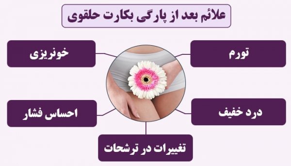  پاره گی پرده بکارت در اثر ورزش و خودارضایی