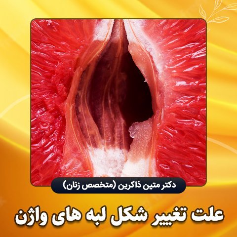  از کجا بفهمیم واژن تنگی داریم