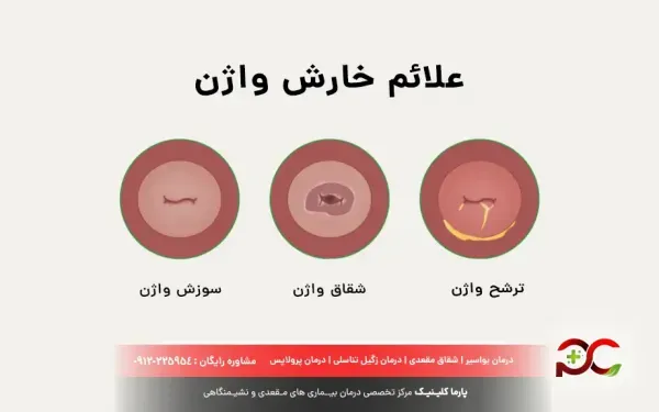  از کجا بفهمیم واژن تنگی داریم