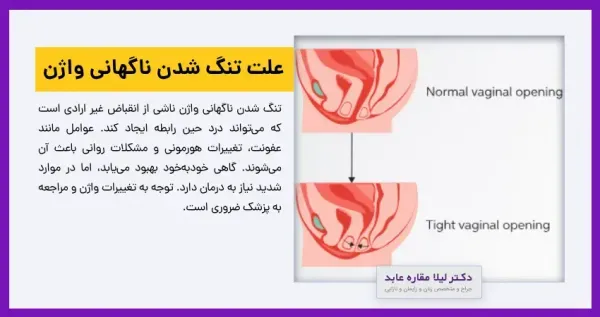  از کجا بفهمیم واژن تنگی داریم