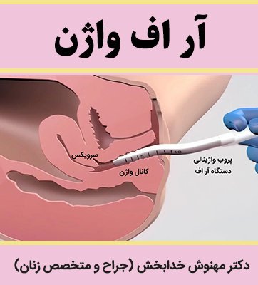  فیلم درمان واژینیسموس با آر اف + هزینه درمان واژینیسموس با آر اف