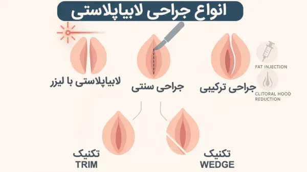  فیلم و عکس عمل زیبایی واژن با بخیه