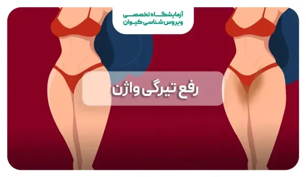 چگونه تیرگی بیکینی واژن را از بین ببریم