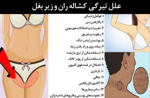  چگونه تیرگی بیکینی واژن را از بین ببریم