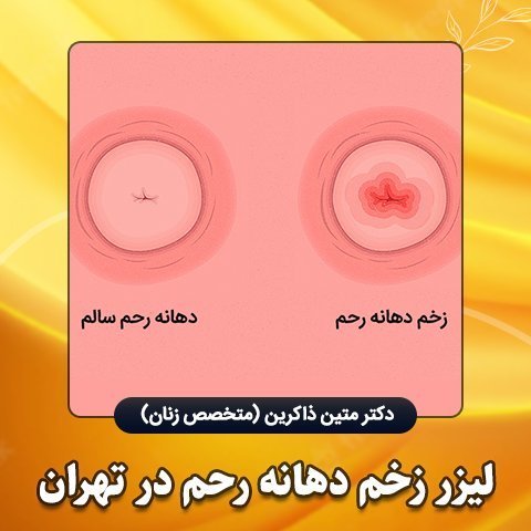  لیزر واژن بیکینی قبل و بعد