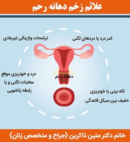  لیزر واژن بیکینی قبل و بعد