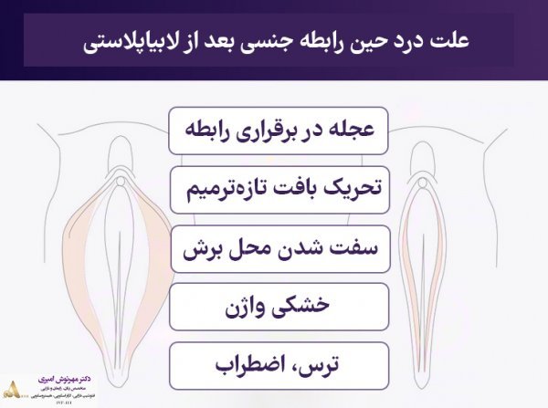  عکس و فیلم قبل و بعد از عمل لابیاپلاستی
