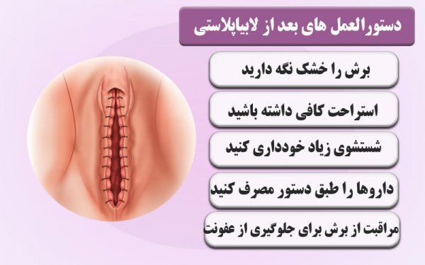  عکس و فیلم قبل و بعد از عمل لابیاپلاستی