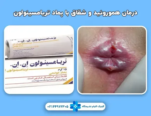  رابطه مقعدی /نزدیکی از پشت تا چه مدت قابل تشخیص است