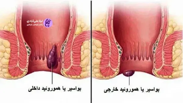  رابطه مقعدی /نزدیکی از پشت تا چه مدت قابل تشخیص است