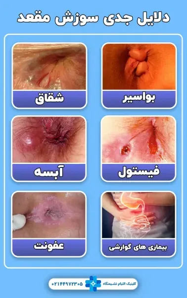  رابطه مقعدی /نزدیکی از پشت تا چه مدت قابل تشخیص است